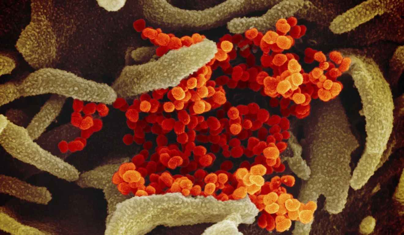 “South China Morning Post”: Коронавирус има 1.000 пута већу споспобност од САРС-а да се веже за људске ћелије - мутације сличне онима који су пронађене у ХИВ-у и Еболи